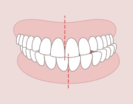 Kattogó, elmozduló állkapocs