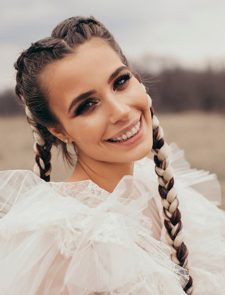 Fogszabályozás Gyakran ismételt kérdések